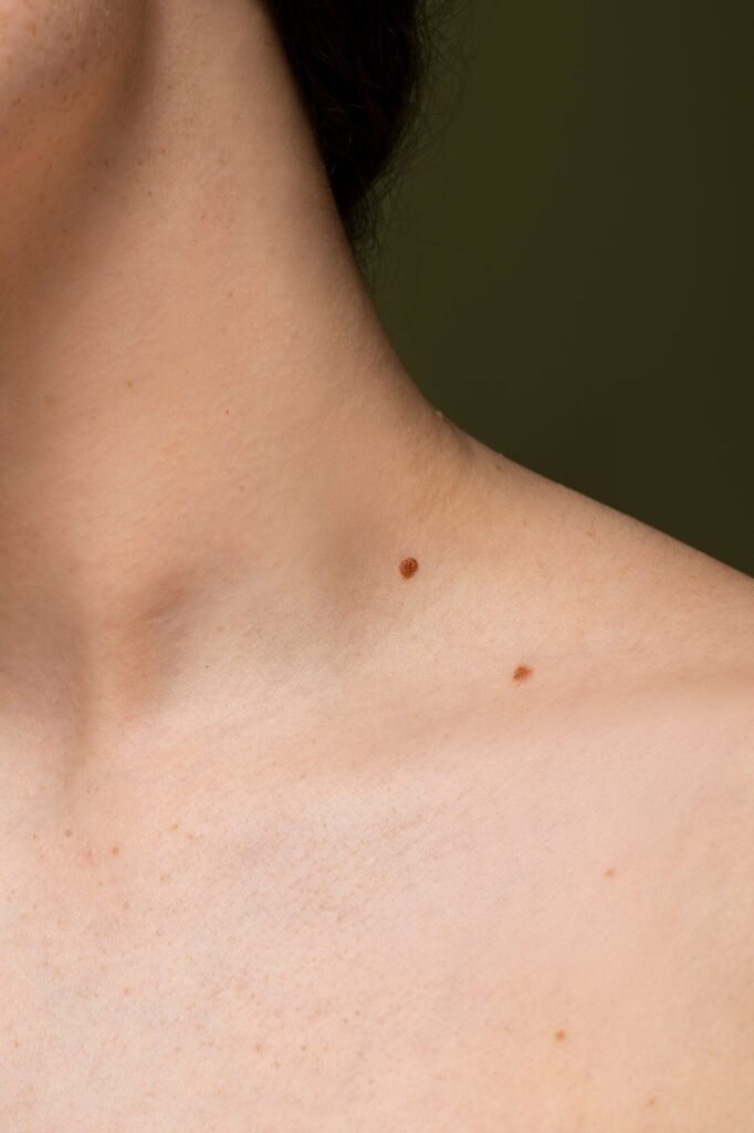 Skin Tag Removal Treatment